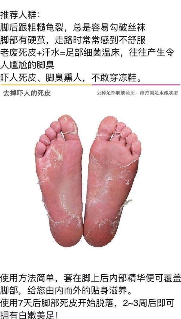 New My Pure Foot脚膜角蛋白护理去角质 60分钟类型