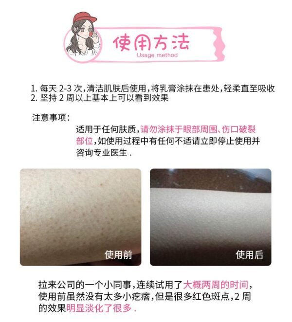 日本KOBAYASHI小林制药去鸡皮软化角质毛囊膏 30g